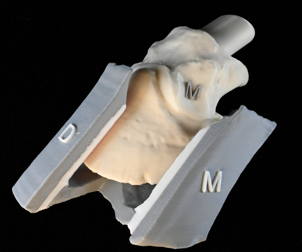 Suspensory Apparatus of the Distal Phalanx (SADP)/Laminitis Model