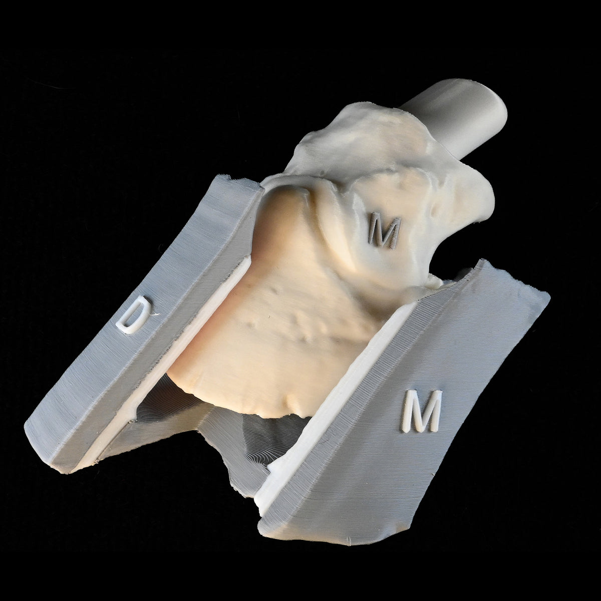 Suspensory Apparatus of the Distal Phalanx (SADP)/Laminitis Model