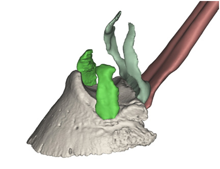 Fig 03. Partial virtual 3D model of the Standardbred stallion foot. The deep digital flexor tendon, collateral ligaments of the coffin (distal interphalangeal) joint and the distal sesamoidean (navicular) bone have been created from MR data. Co-registered CT data has been used to create the distal phalanx (coffin bone) and distal sesamoidean (navicular) bone.