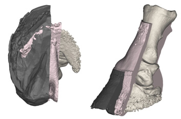 Fig 08. The foot of a severe chronic laminitis case (Model 007) illustrating the effect of severe chronic laminitis on the horse foot. Notably the displaced distal phalanx and its associated dermis have penetrated the necrotic sole.